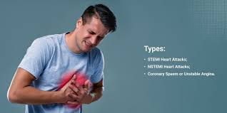 Heart attack symptoms